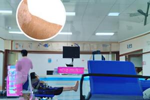 他克莫司能抑制黑色素形成嗎